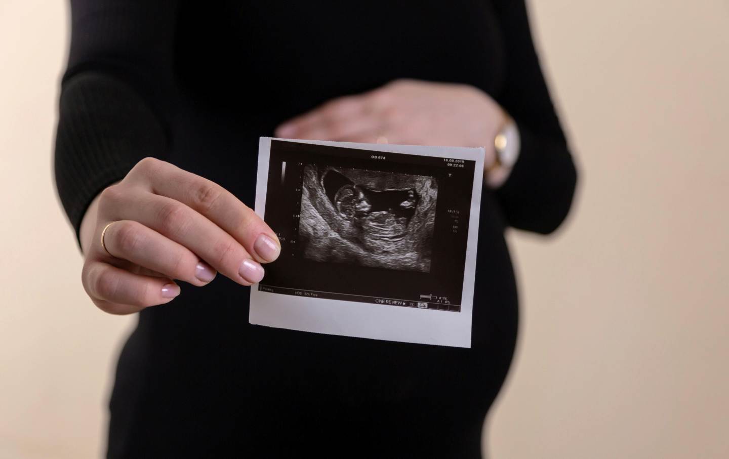 What Affects Embryo Transfer Success in Surrogacy?