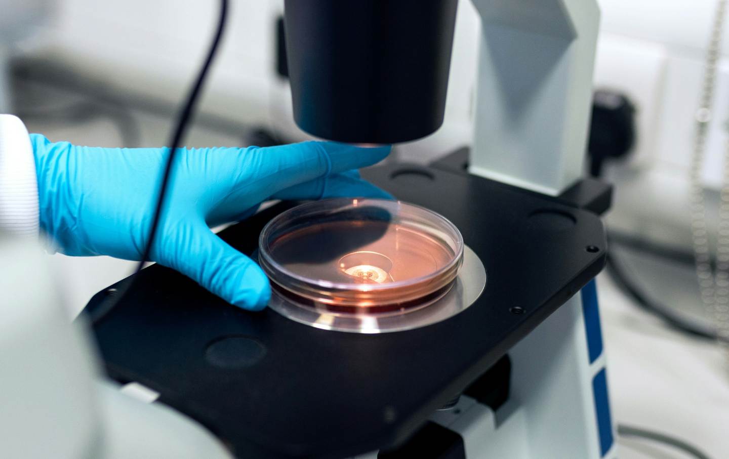 Do I Need Embryos Before Starting Surrogacy, and How Many Should I Create?